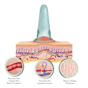 Add on: Cupping 10min